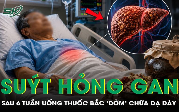 Người đàn ông 61 tuổi suýt hỏng gan sau 6 tuần uống thuốc bắc 'dởm'