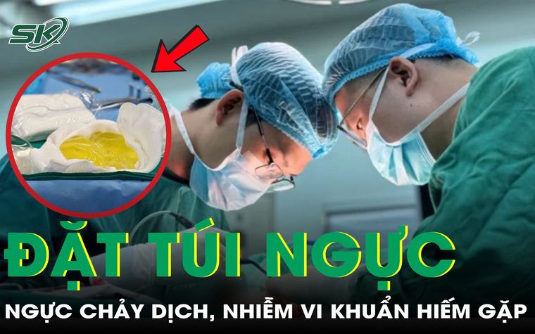 Đặt túi ngực 2 lần, người phụ nữ 38 tuổi nhiễm vi khuẩn hiếm gặp